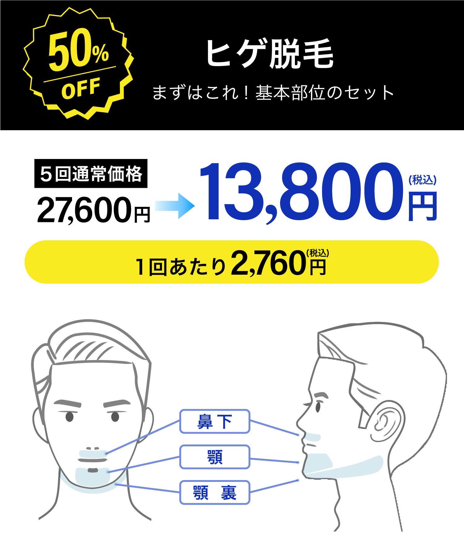 イデア皮膚科クリニック メンズ脱毛
