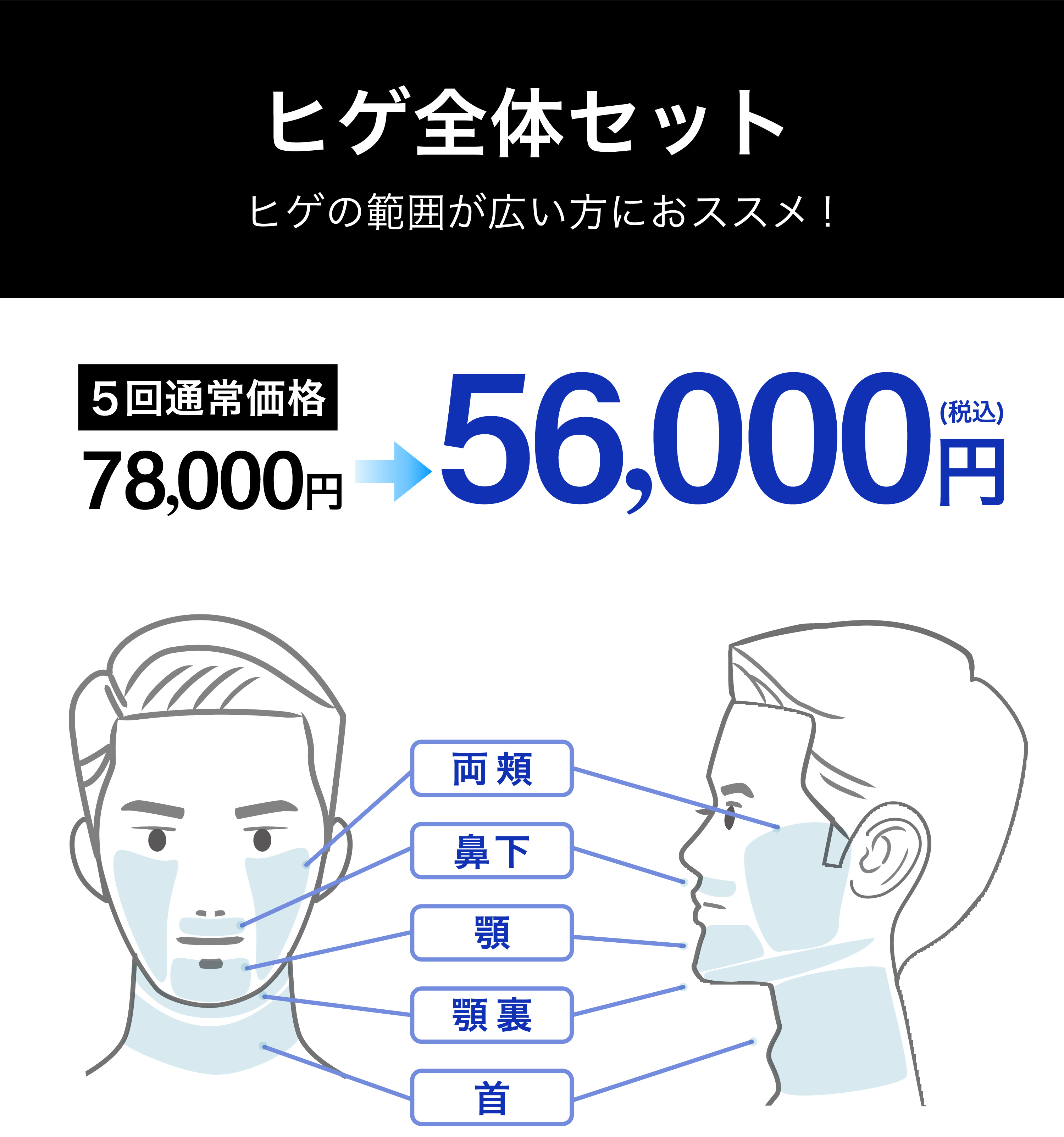 イデア皮膚科クリニック メンズ脱毛
