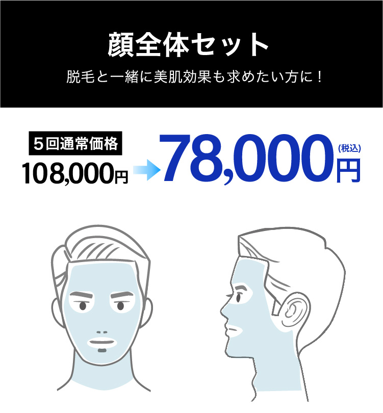 イデア皮膚科クリニック メンズ脱毛